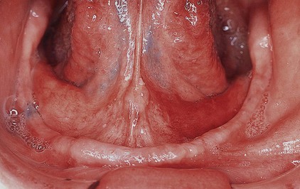 Philadelphia Illustration Dept./Elsevier