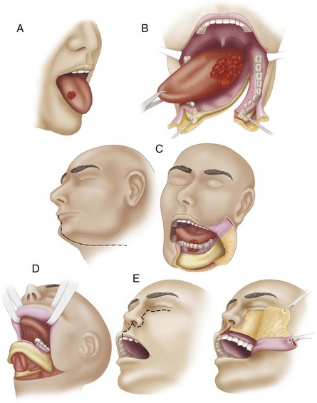 B9780323055895000081_f008-045-9780323055895