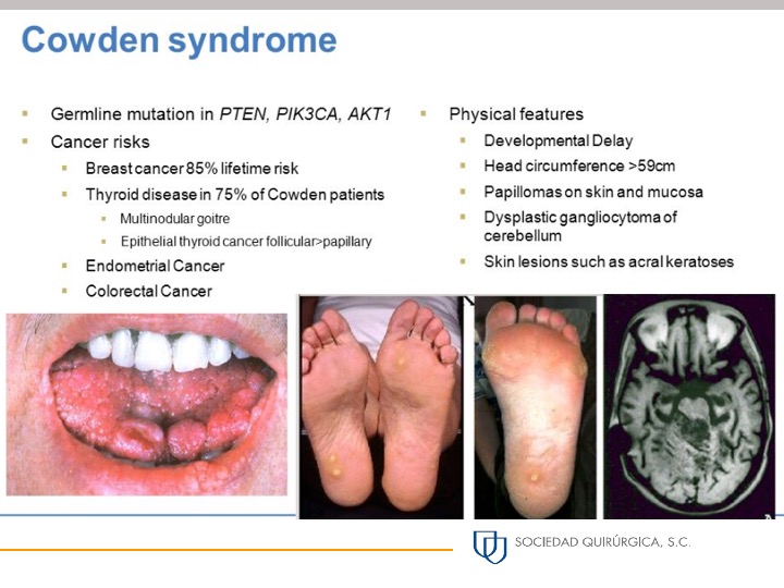 Slide2