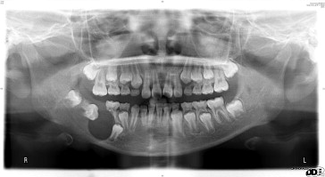 1-s2.0-S1991790213000792-gr1