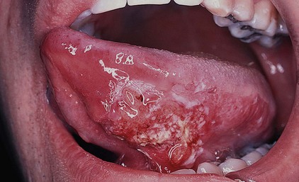 Philadelphia Illustration Dept./Elsevier