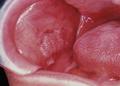 Philadelphia Illustration Dept./Elsevier