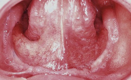 Philadelphia Illustration Dept./Elsevier