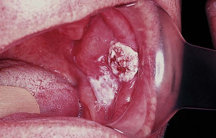 Philadelphia Illustration Dept./Elsevier