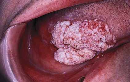 Philadelphia Illustration Dept./Elsevier