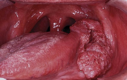 Philadelphia Illustration Dept./Elsevier