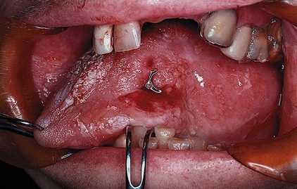 Philadelphia Illustration Dept./Elsevier