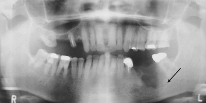 B9780323055895000081_f008-028-9780323055895