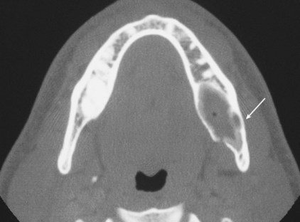 B9780323055895000081_f008-029-9780323055895