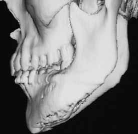 Philadelphia Illustration Dept./Elsevier