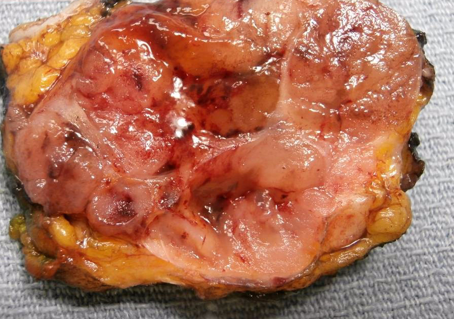 11843489014_e764b7846e_b