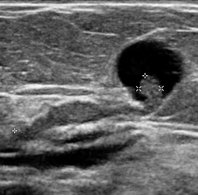 64db50775d6c438409d5c3562b3f6a_big_gallery