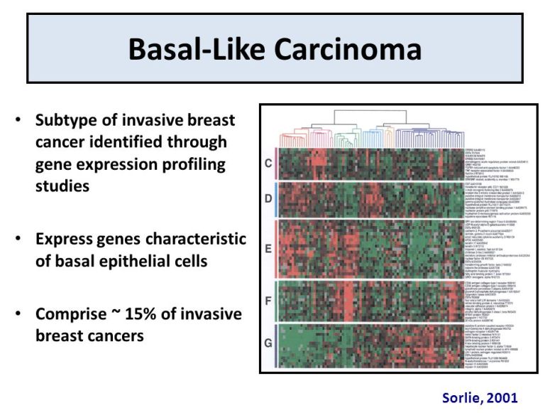 Basal-Like+Carcinoma+Subtype+of+invasive+breast+cancer+identified+through+gene+expression+profiling+studies.