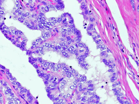 histology-PTC3-high-powerws