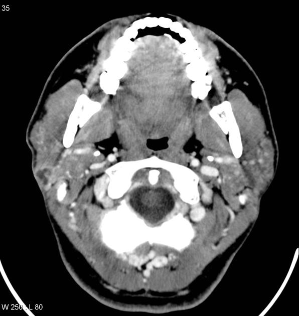 24f1f9d76f99646bc7ec674d51a9de_big_gallery