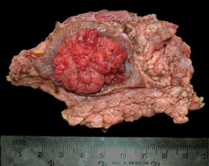 37d0c754213d1c1ecd29b1a3f34cef1c