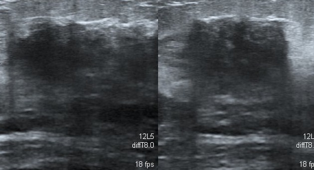 72004d613f0fdcb31dd3b59df60c34_big_gallery