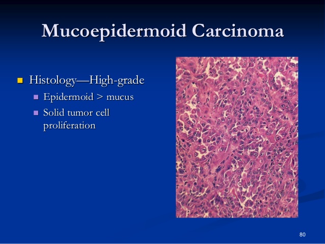 salivary-glands-disorders-ii-80-638