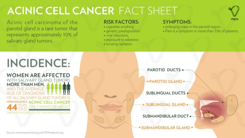 acinic-cell-cancer-infographic-1024x576.jpg
