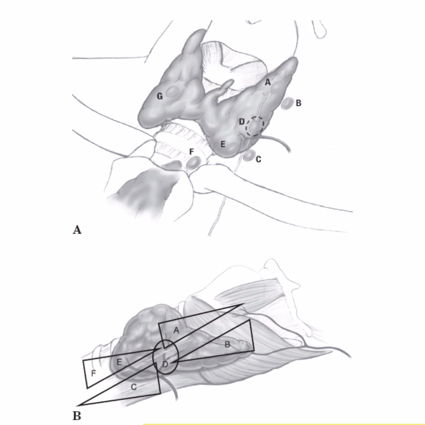 Nomenclature system for parathyroid location