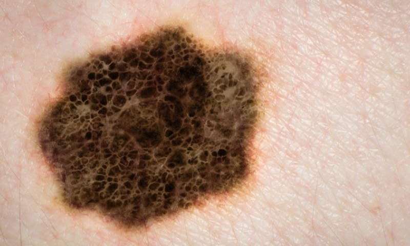 melanomastag