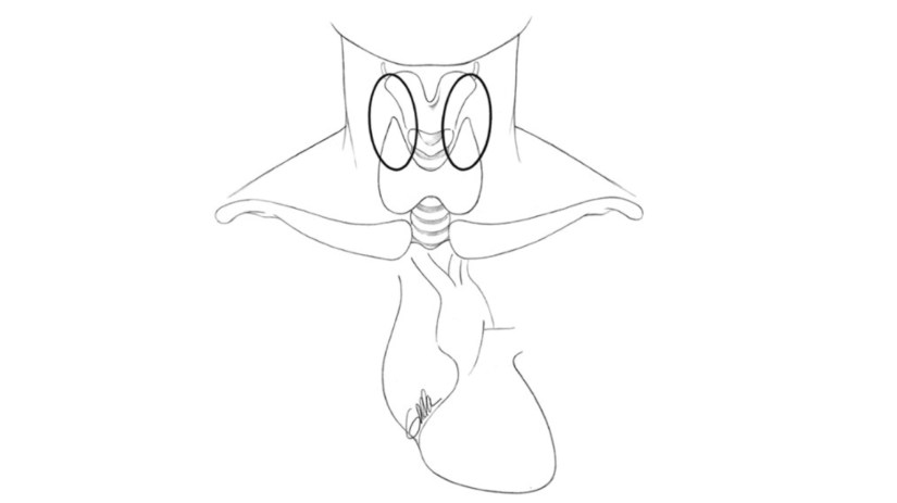 The area of dispersal of the PIVs is limited by their short embryonic course