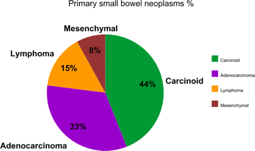 Carcinoid Tumors / Neuroendocrine Tumors of the Small Bowel – Etiology ...