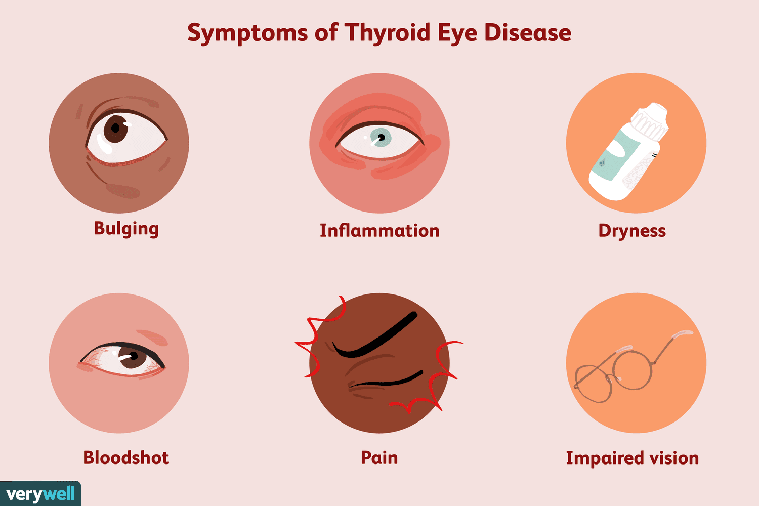 Pathogenesis of Hyperthyroidism – Rodrigo Arrangoiz MS, MD, FACS, FSSO